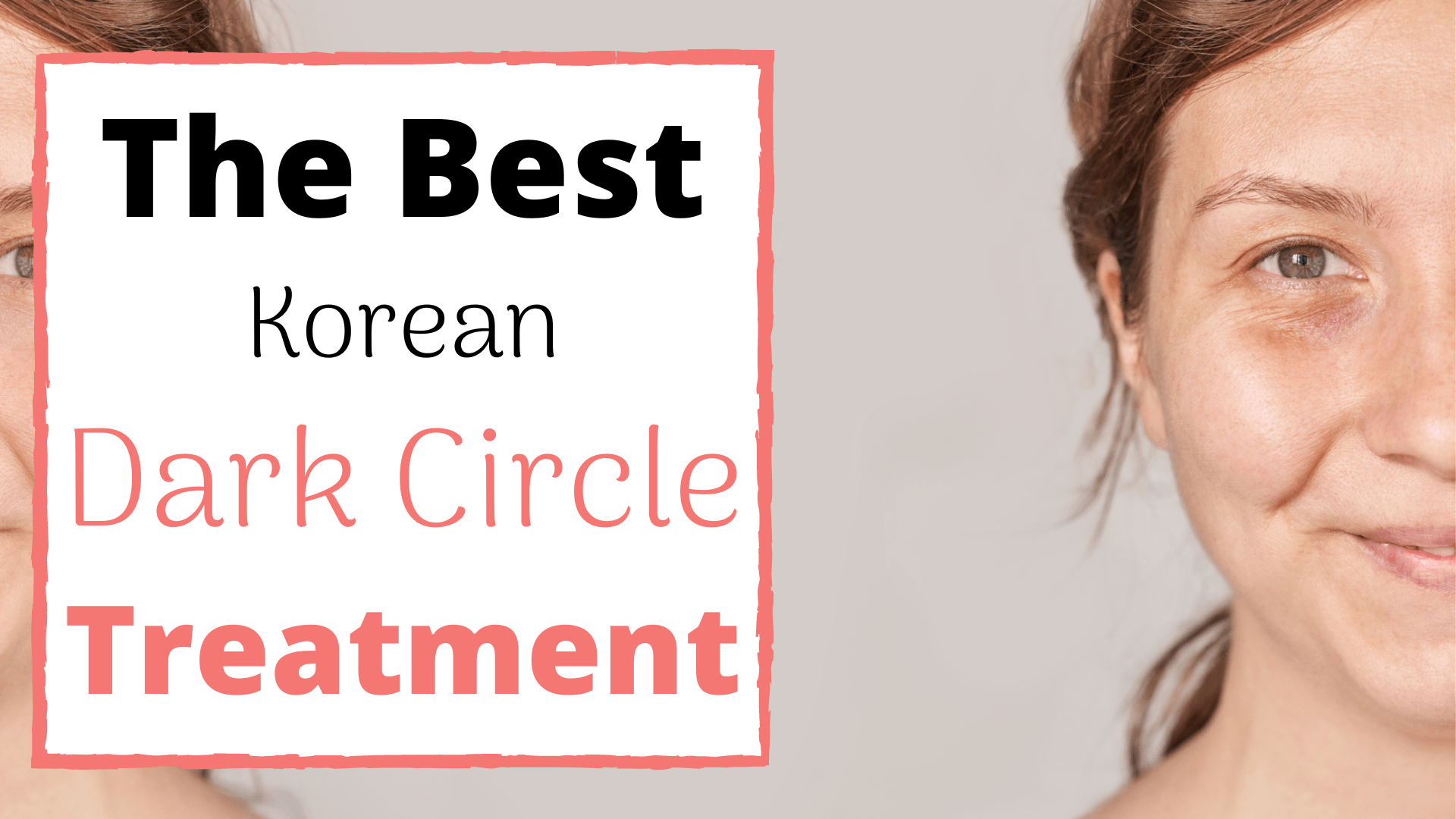The Best Korean Dark Circle Treatment, Procedures & Skin Clinics