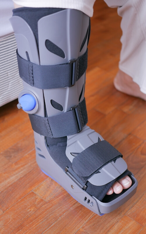 CAM Boots and their Uses in Rehabilitation of Foot and Ankle Injuries