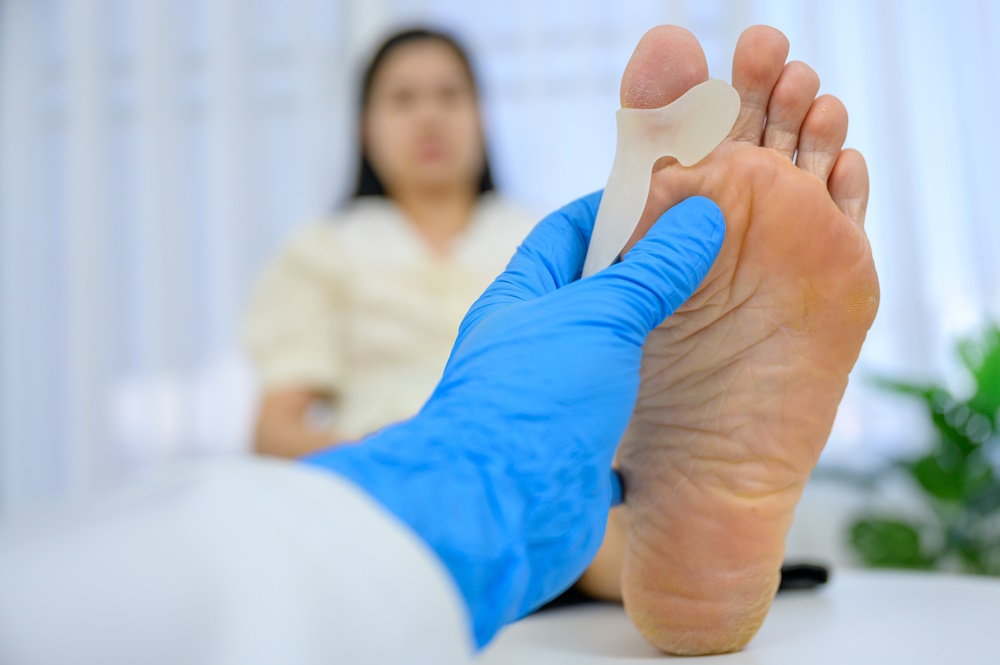 How To Get a VA Rating For Flat Feet We Make