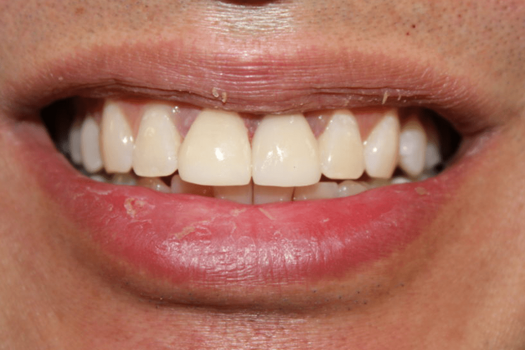 Benicia CA Dentist Meade Family Dental Smile Gallery