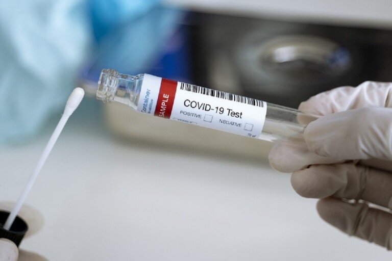 Covid19 au Bénin le test de dépistage PCR désormais interdit sans