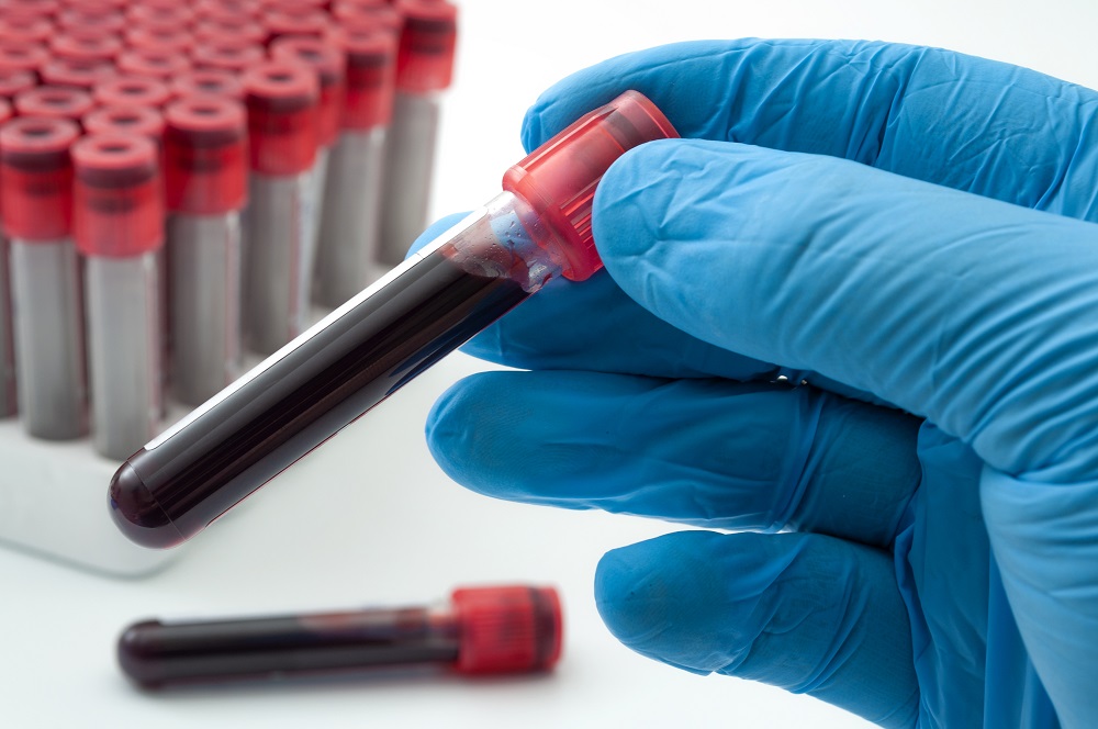 Phlebotomy | Bergen Community College