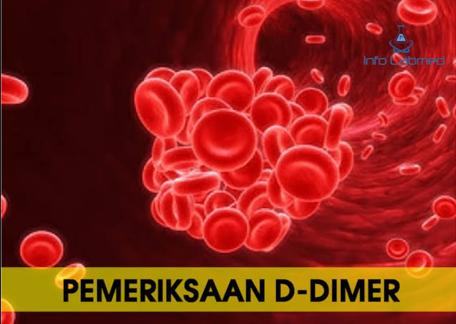 Untuk Apa Kita Periksa dDIMER.?