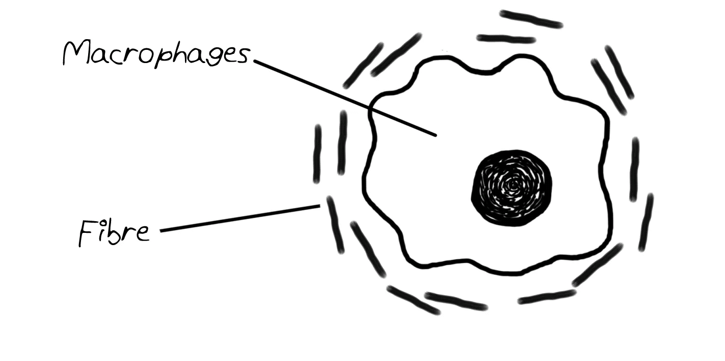 What is a Boysenberry? Where is it Grown, Health Benefits & More