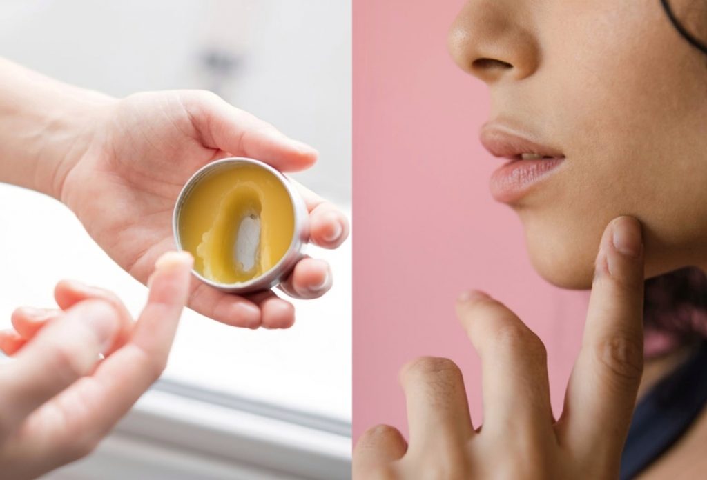 How to Heal Dry Lips 9 Best Dry Lips Treatments Be Spotted