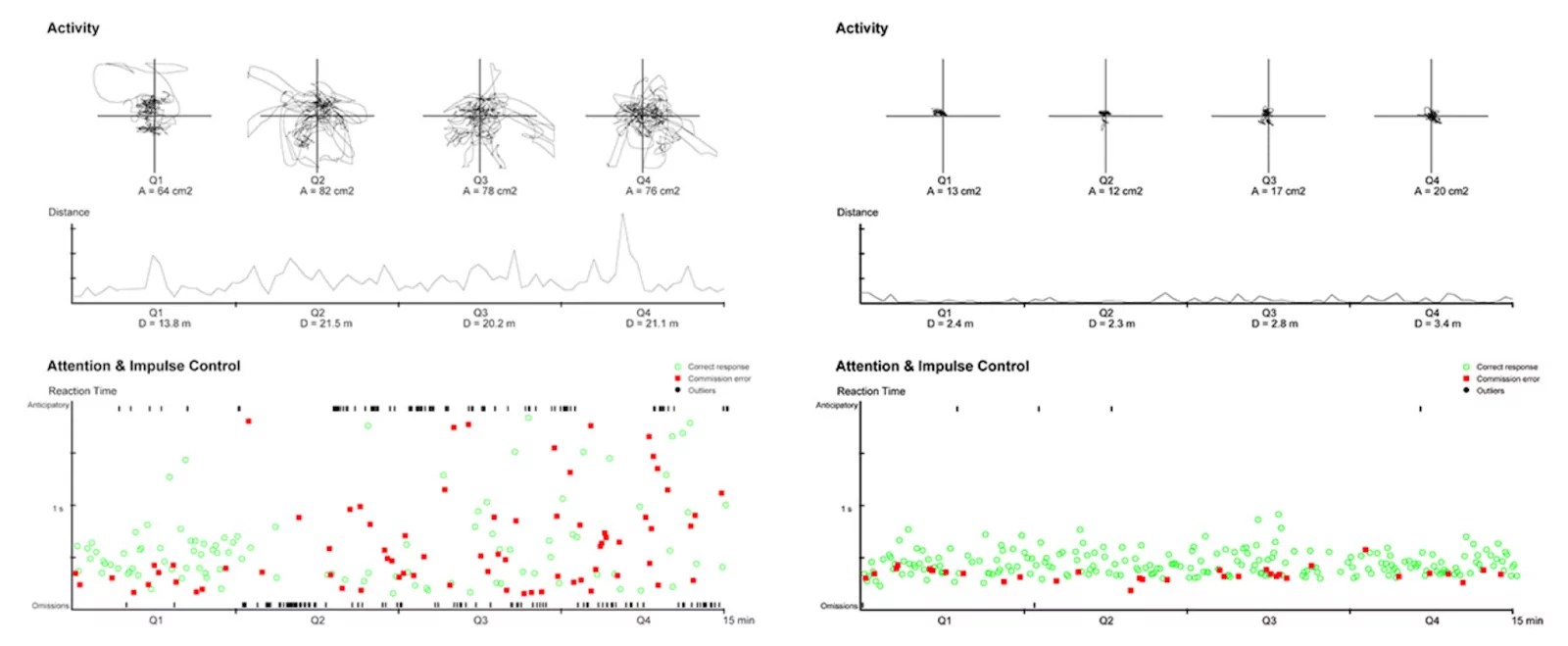 ADHD Testing Services BestMind Behavioral Health