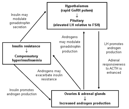 Polycystic ovary syndrome Aetiology BMJ Best Practice