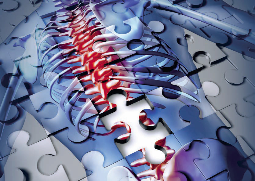 Traveling after Spinal Fusion Surgery Beta Va'K'tion