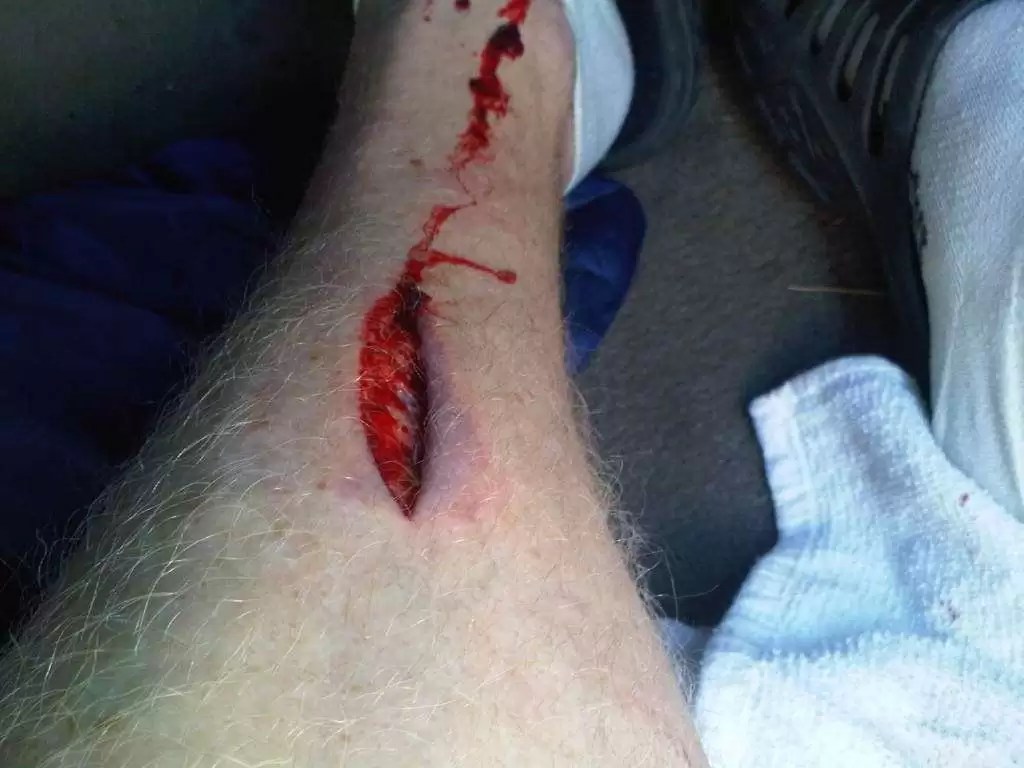 BetterRide Mountain Bike Skills Tips