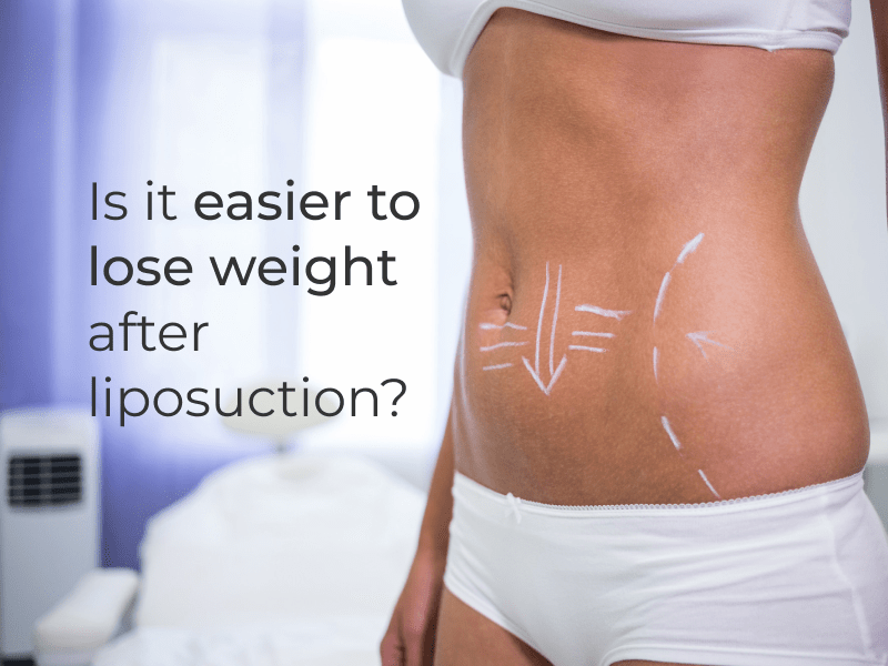 Is it easier to lose weight after liposuction? Better Weigh Medical