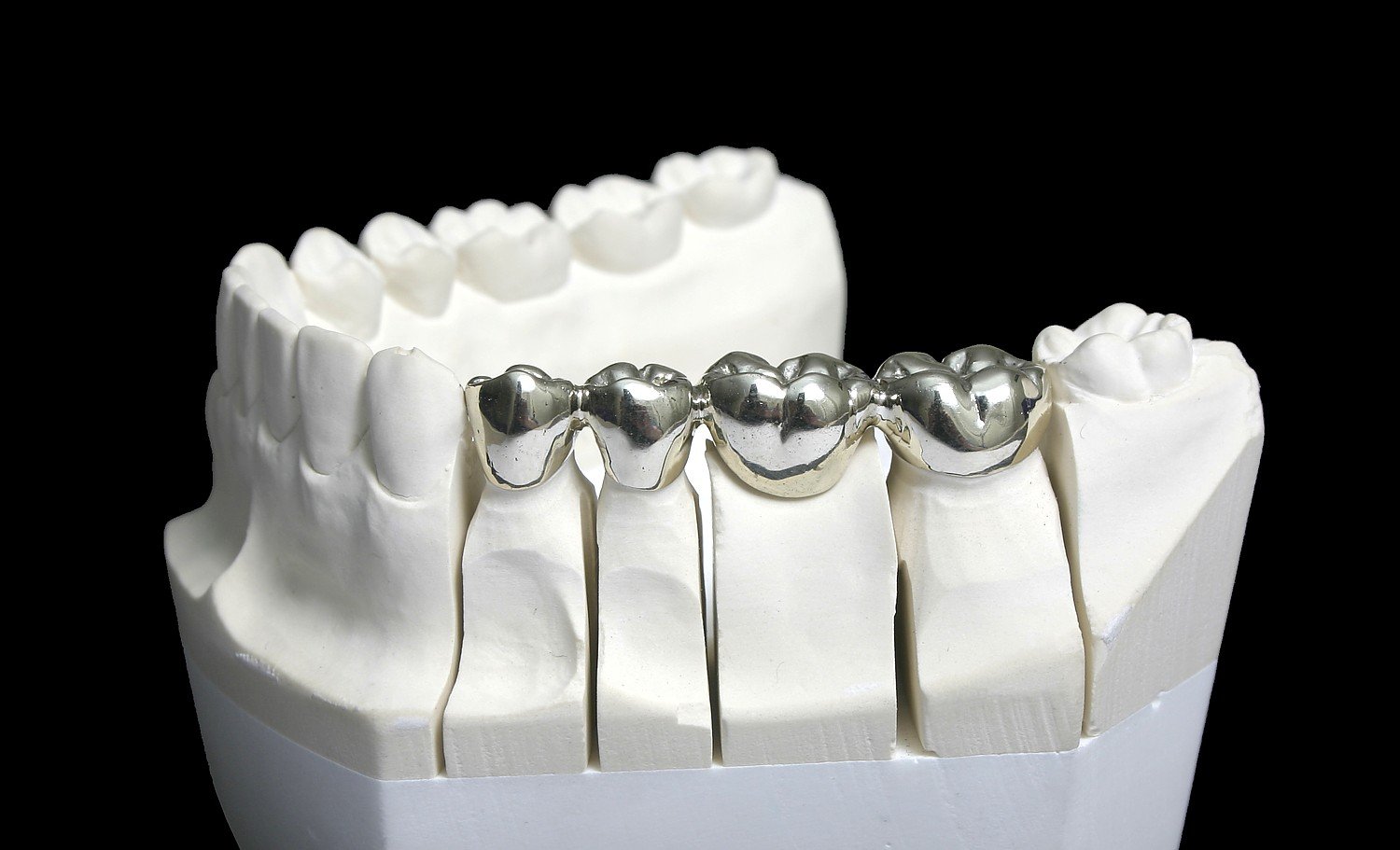 Dentistry Metal Refining Betts Refining