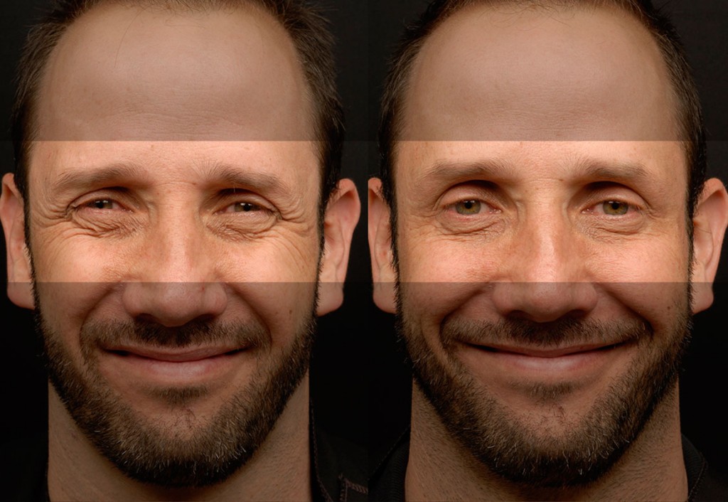 BoosmeticXeoin Beyer Eye Associates Eye Care Monmouth County NJ