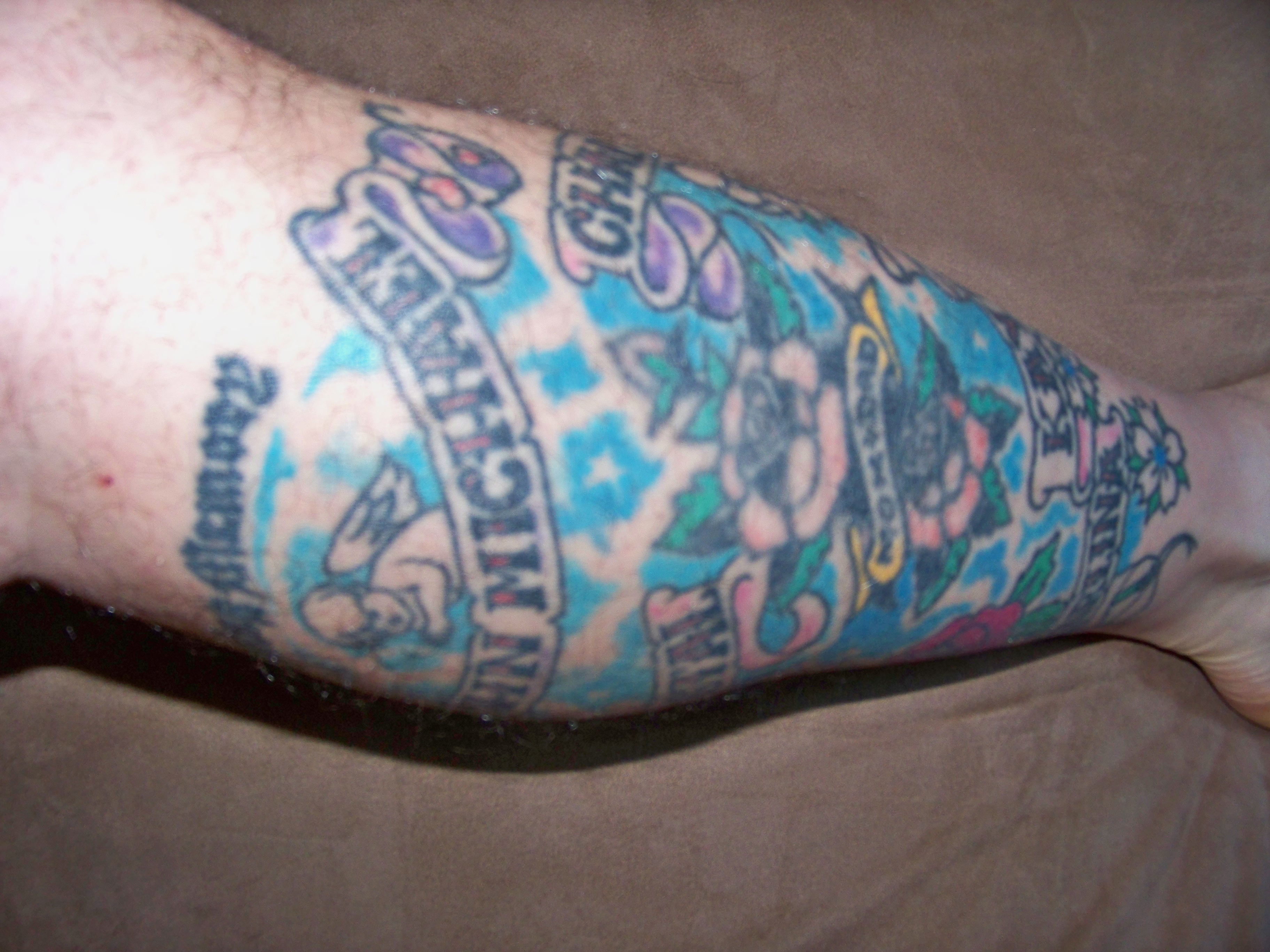 burn survivor Beyond Recognition