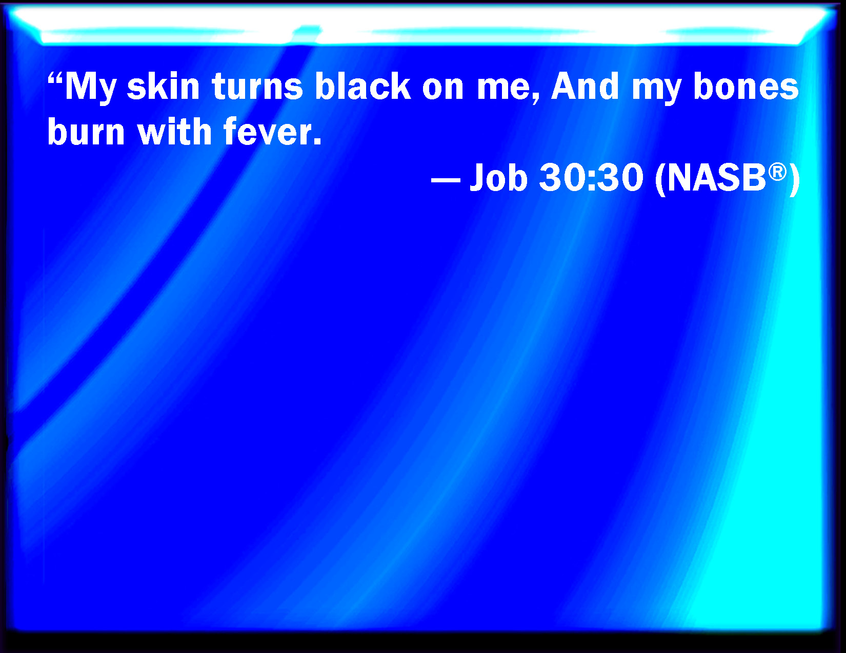 Job 3030 My skin is black on me, and my bones are burned with heat.