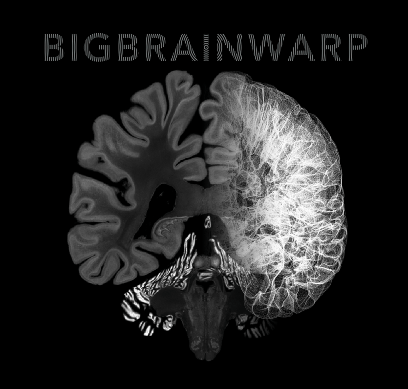 BIG BRAIN WARP — The Big Brain Warp documentation