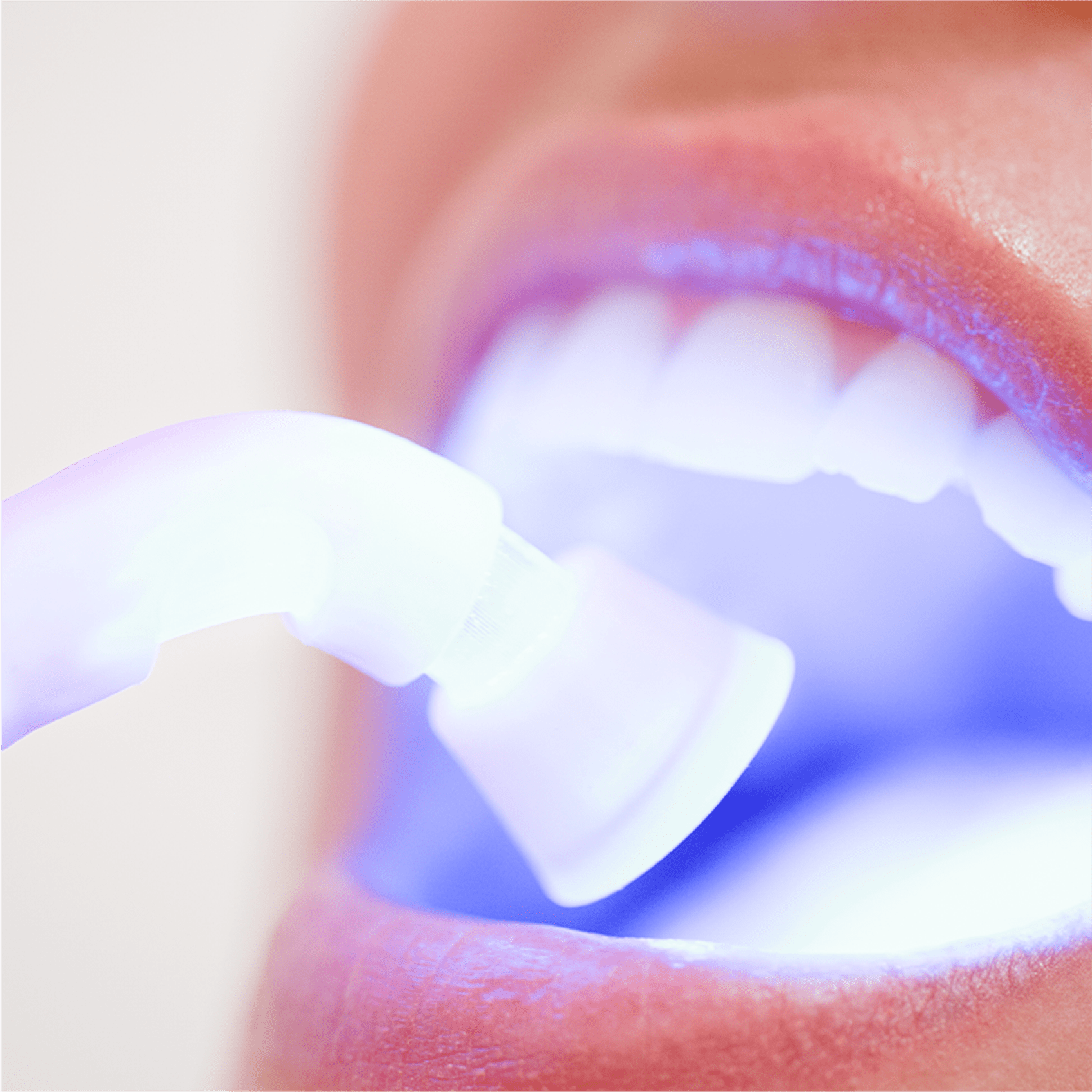 Cosmetic Bigfork Dental