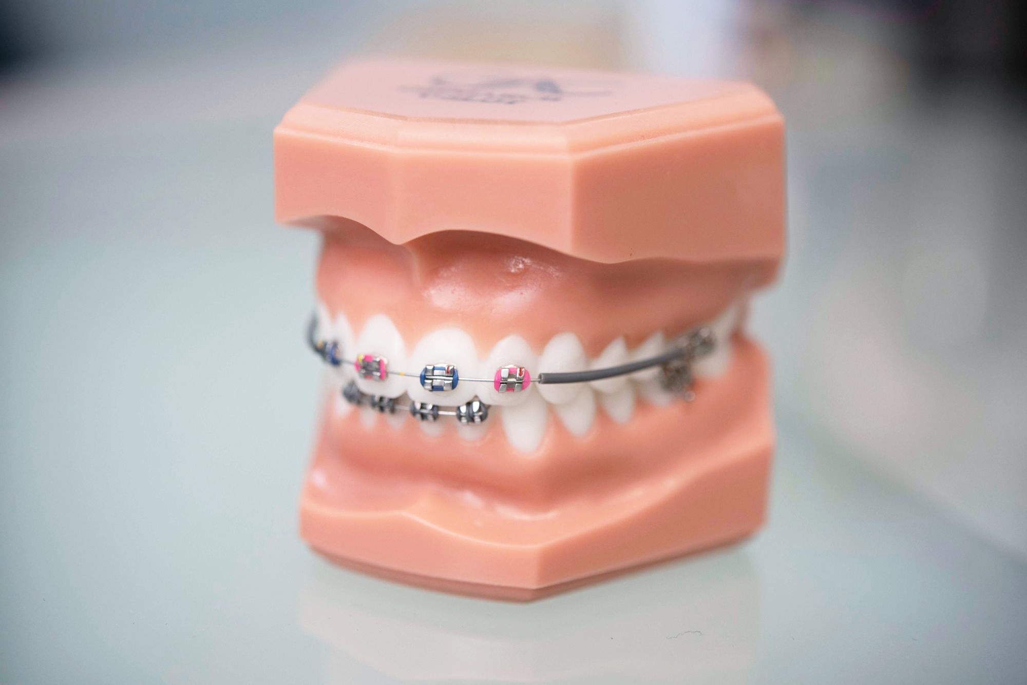 Metal Braces Braces San Ramon Bigman Orthodontics