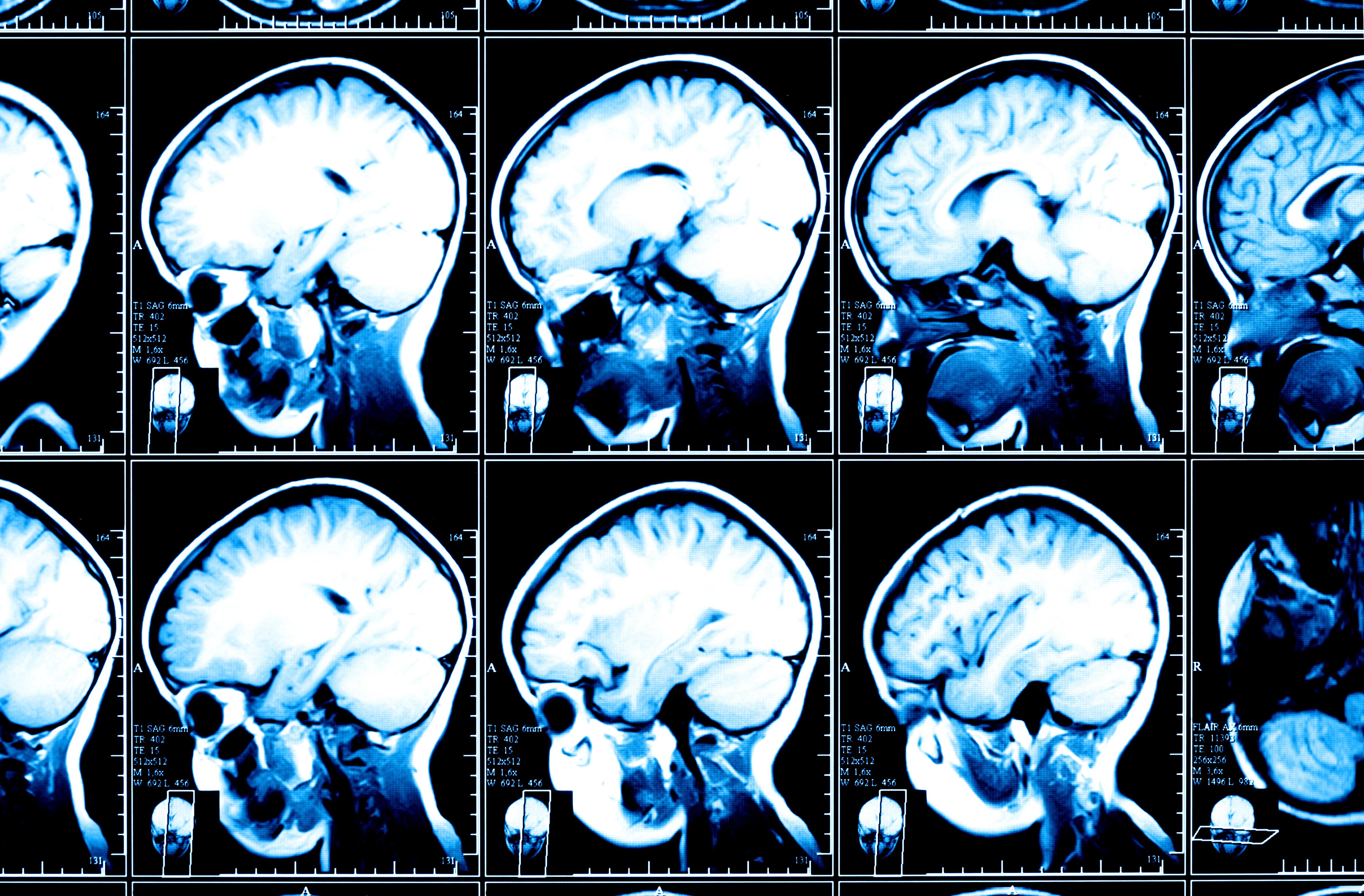 The Brain Scan Image and the Dangers of Brain Porn Big Think