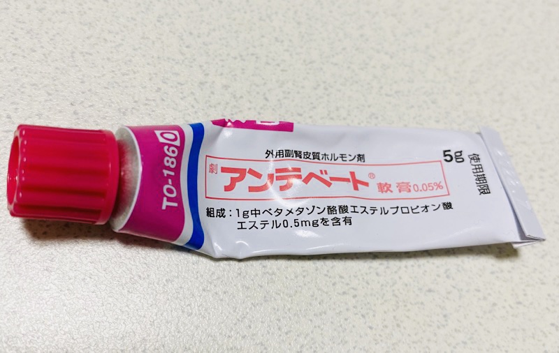 【脂漏性皮膚炎・ニキビ・アトピー】私の処方薬を紹介 脂漏性皮膚炎・アトピー・毛穴改善blog