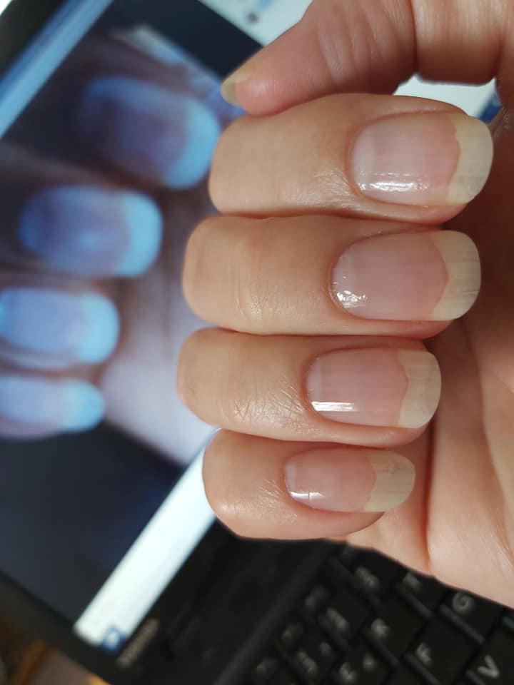 Bild meine Nägel vor einem aktuellen Maniküre, Naturnagel & Nagelpflege