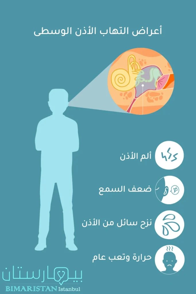 Treatment of otitis media for adults and how to prevent Bimaristan