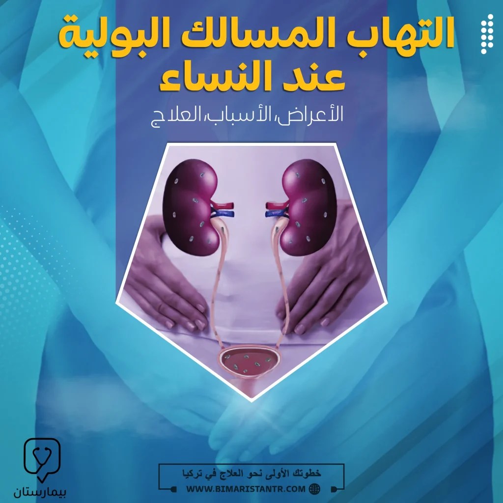 Urinary tract infection in women symptoms, causes, treatment