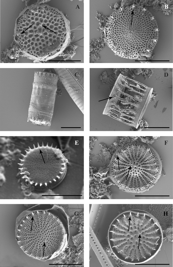 Freshwater Diatoms Identification