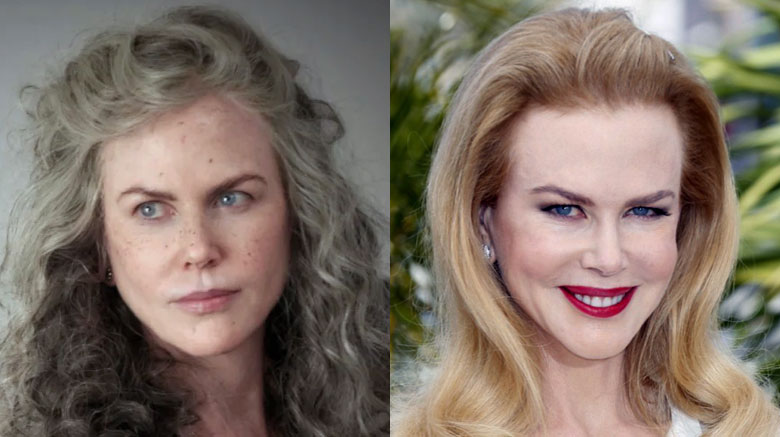 The Plastic & Cosmetic Surgery Epidemic