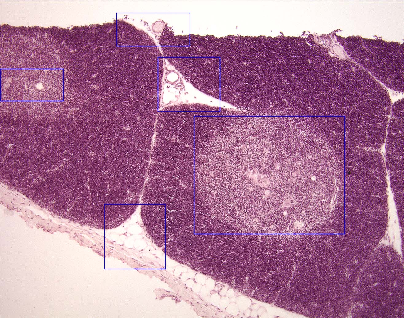 100X Magnification of Thymus with Hot Spots to Hyperlinked Histology