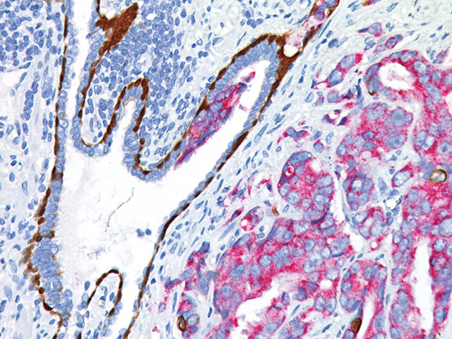 Multiplex IHC™ Detection Biocare Medical