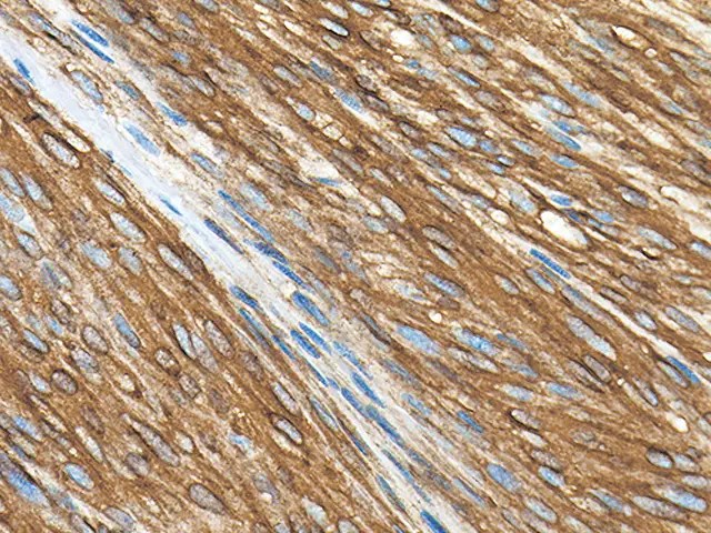 CD117/c-kit Antibody - Biocare Medical