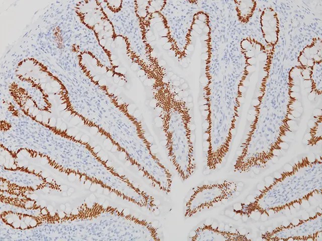 CDX2 (RM) - Biocare Medical