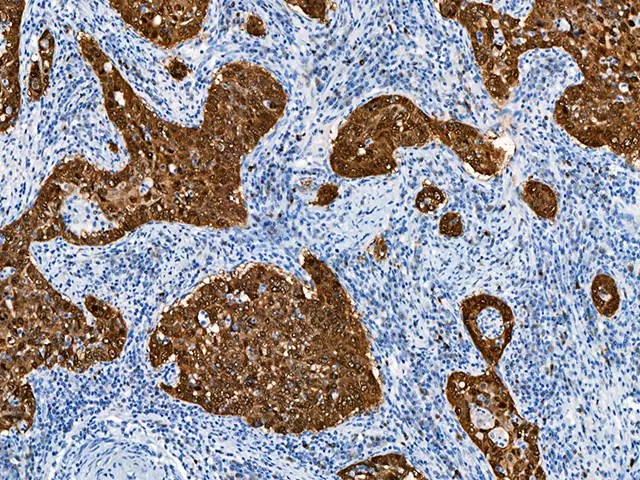 p16 Antibody IVD | Immunohistochemistry | Buy Online