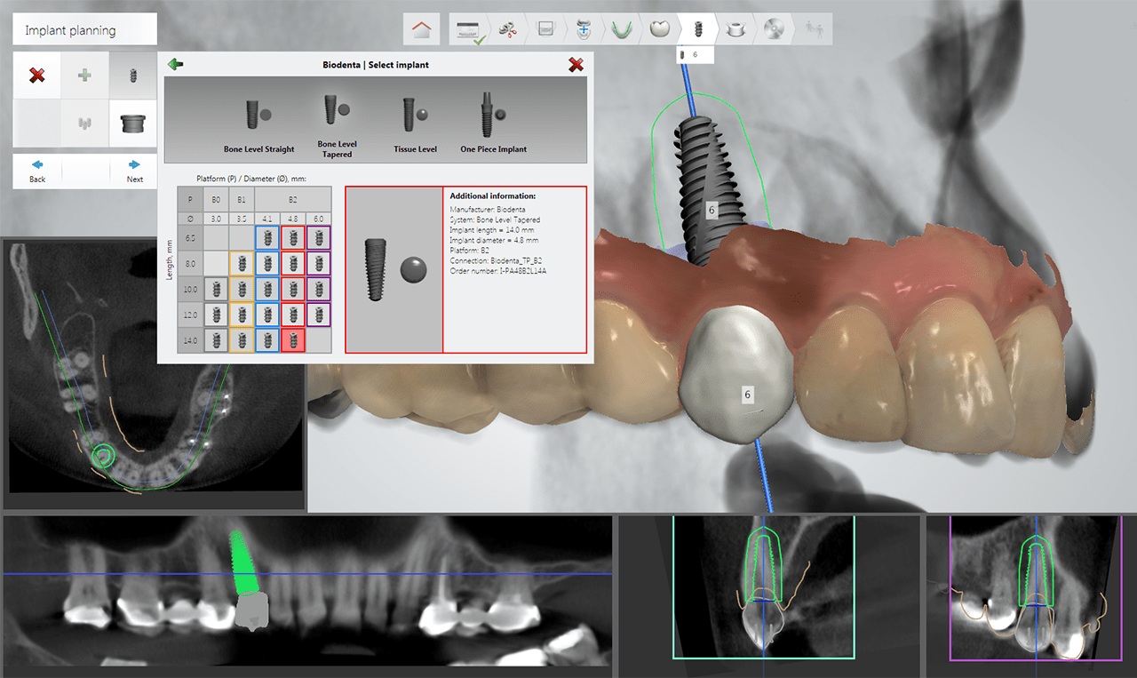 Guided Surgery Biodenta Your Total Solution Provider
