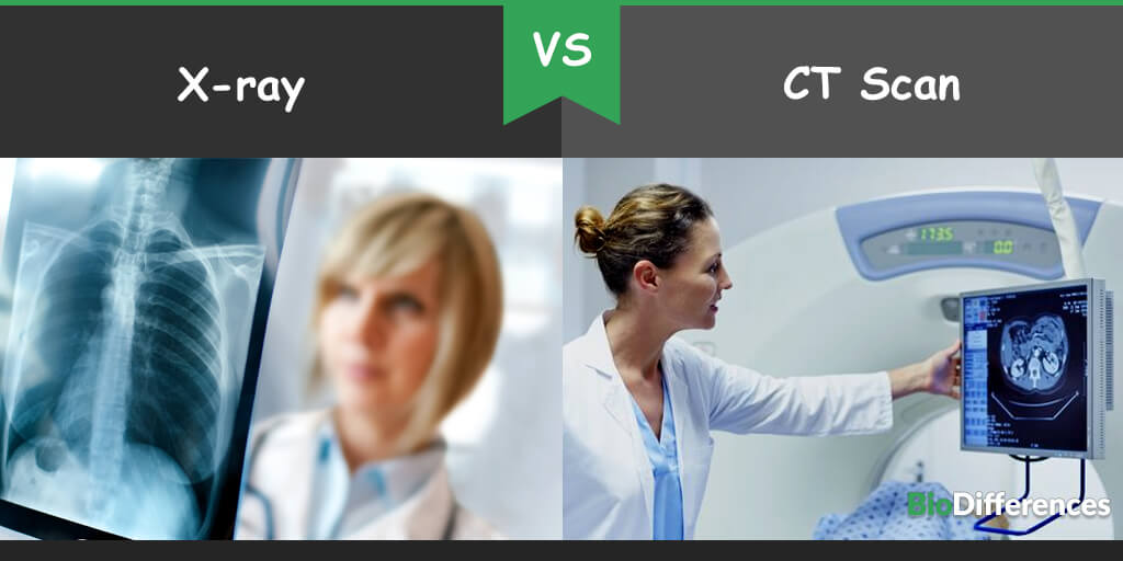 Difference Between Xray and CT Scan Bio Differences
