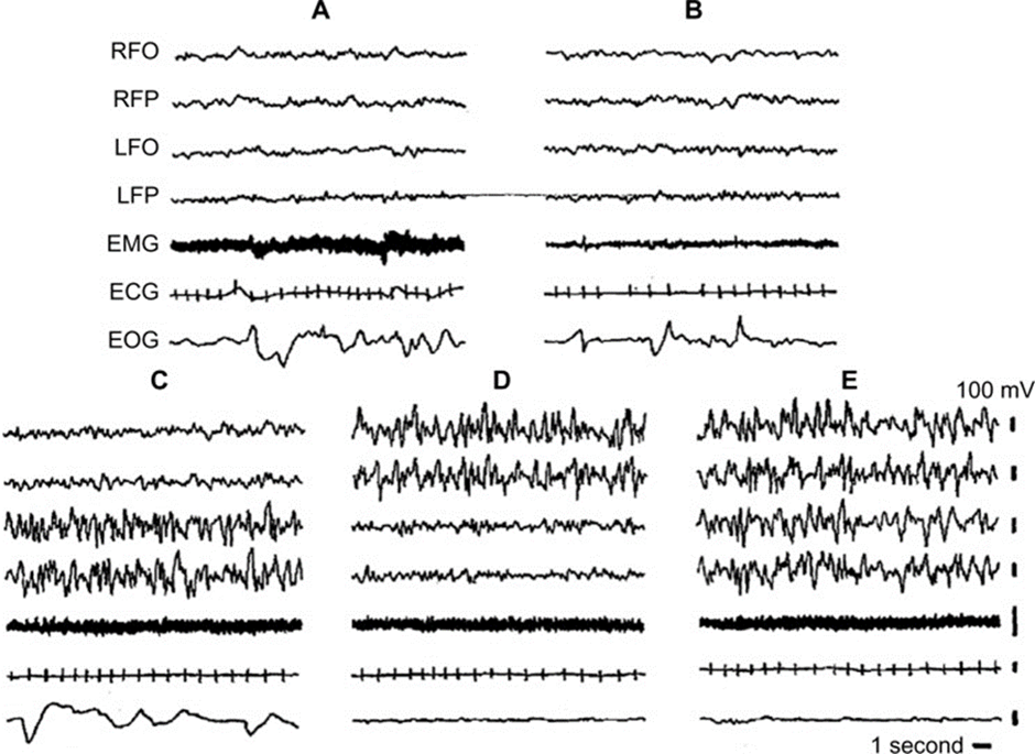 A Mathematical Representation of Brain Activity During Sleep