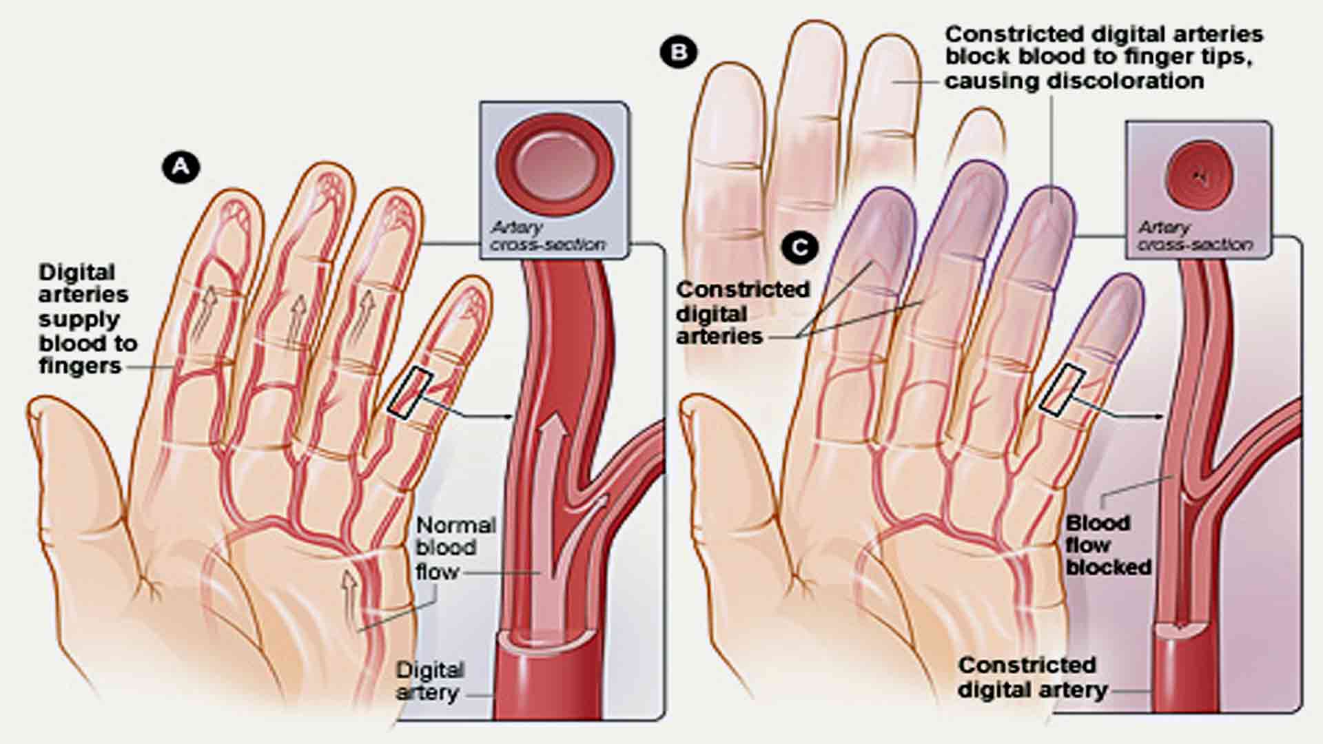 Temperature Biofeedback in Health Issues and Performance Management