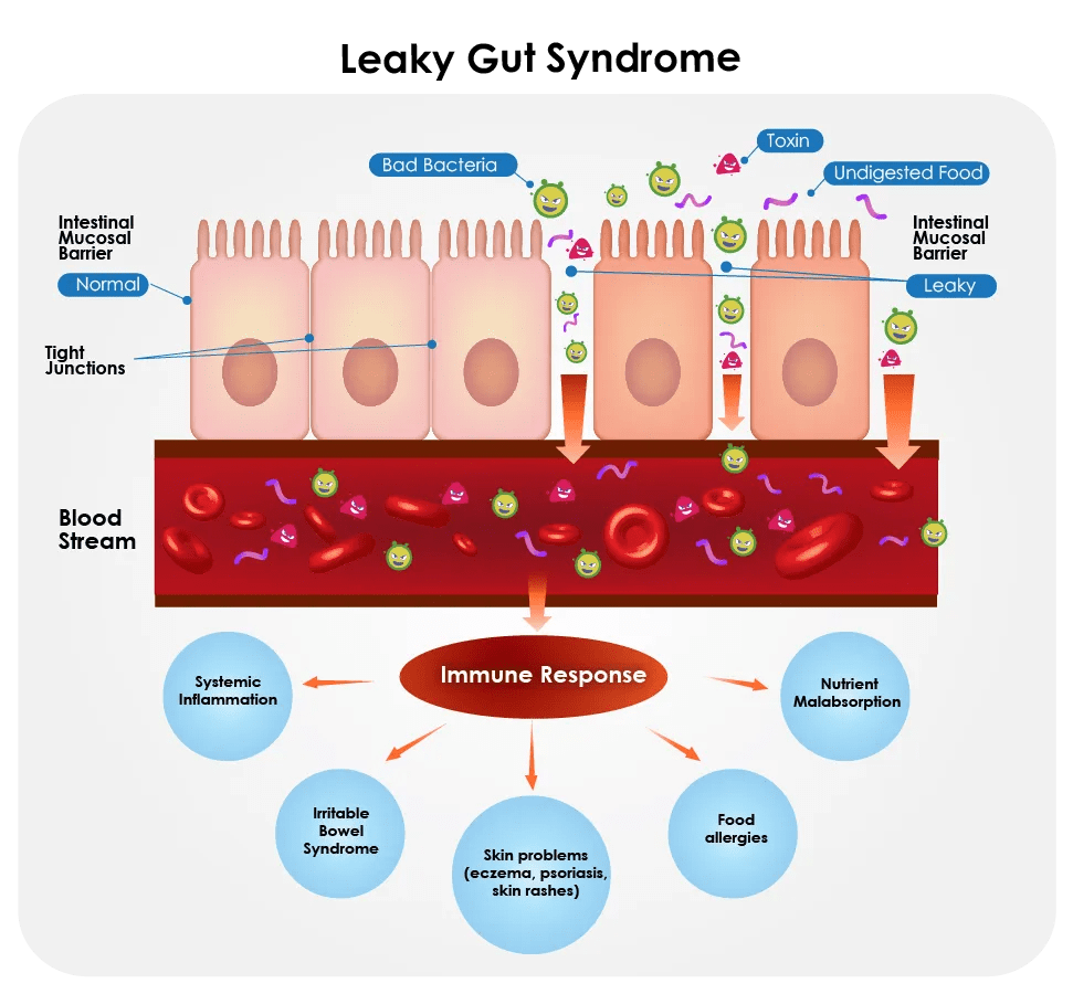 Leaky Gut Weight Gain: Explained Biom Probiotics, 50% OFF
