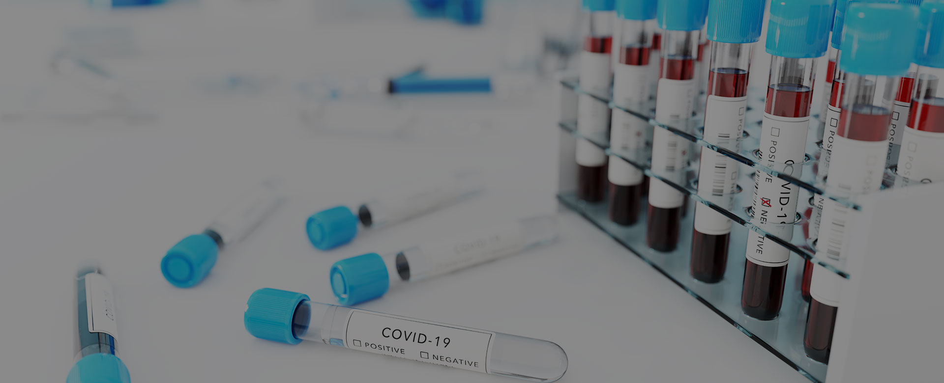 Covid-19: Attivazione Test Sierologici E Tamponi Biomolecolari - Bioscience Institute 780_x_1920_jpg