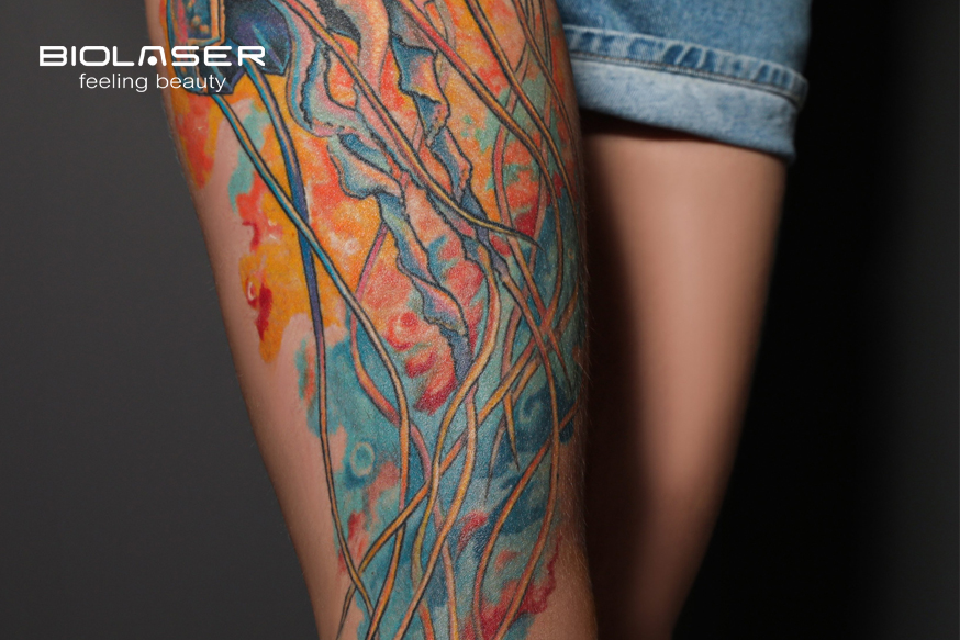Posso Fare Epilazione Laser Se Ho Dei Tatuaggi? Si O No? - Biolaser 583_x_874_jpg