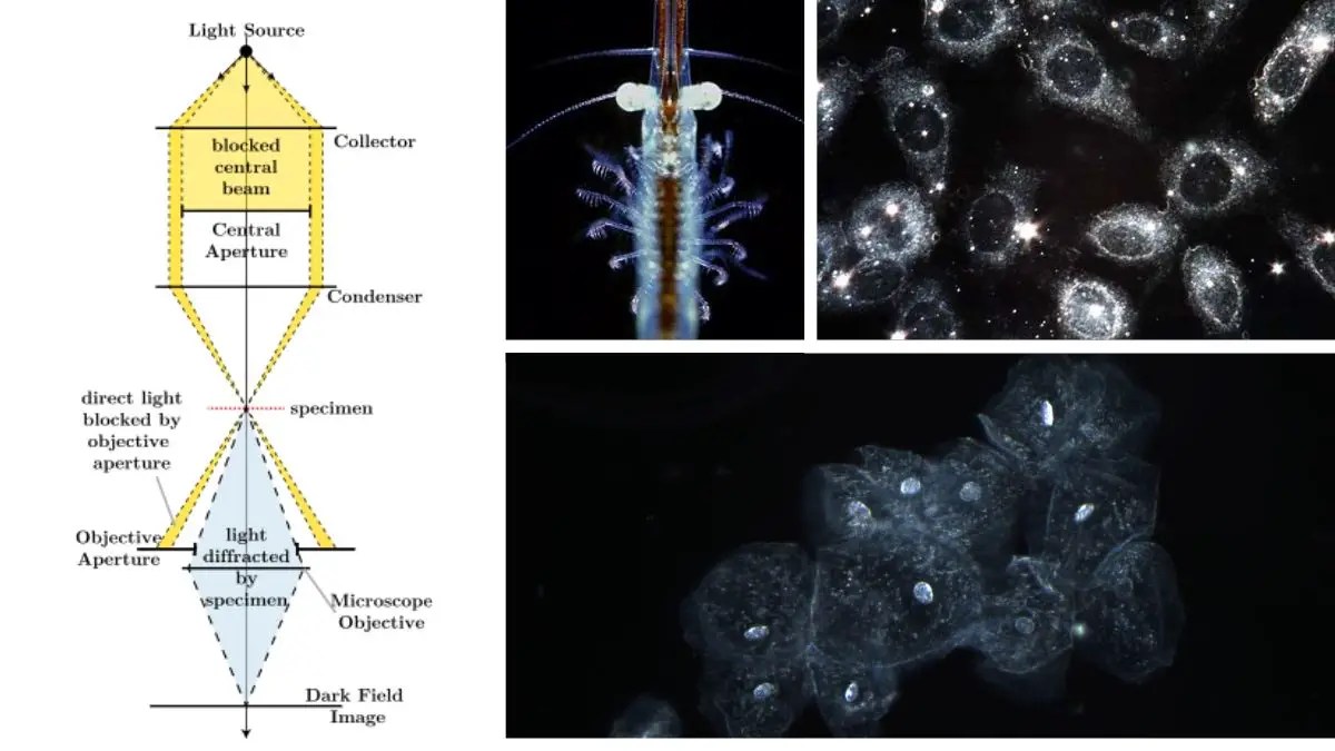 Dark Field Microscopy Principle, Parts, Procedure, Uses Biology