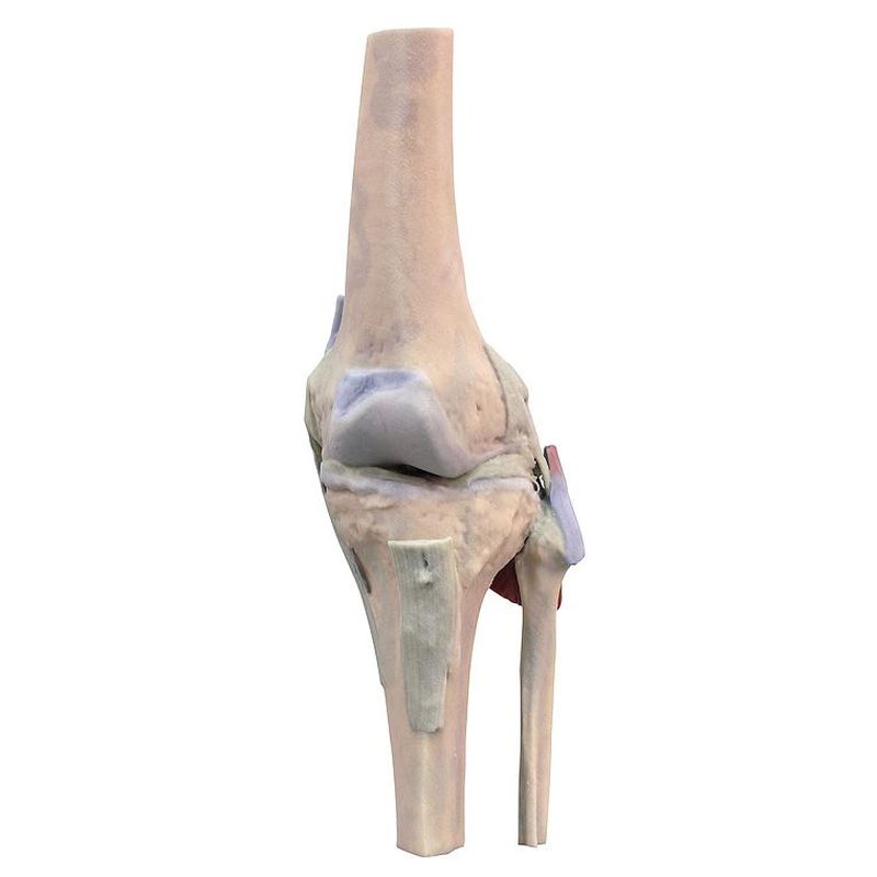 MP1805 Knee Joint Extended Biomedical Models