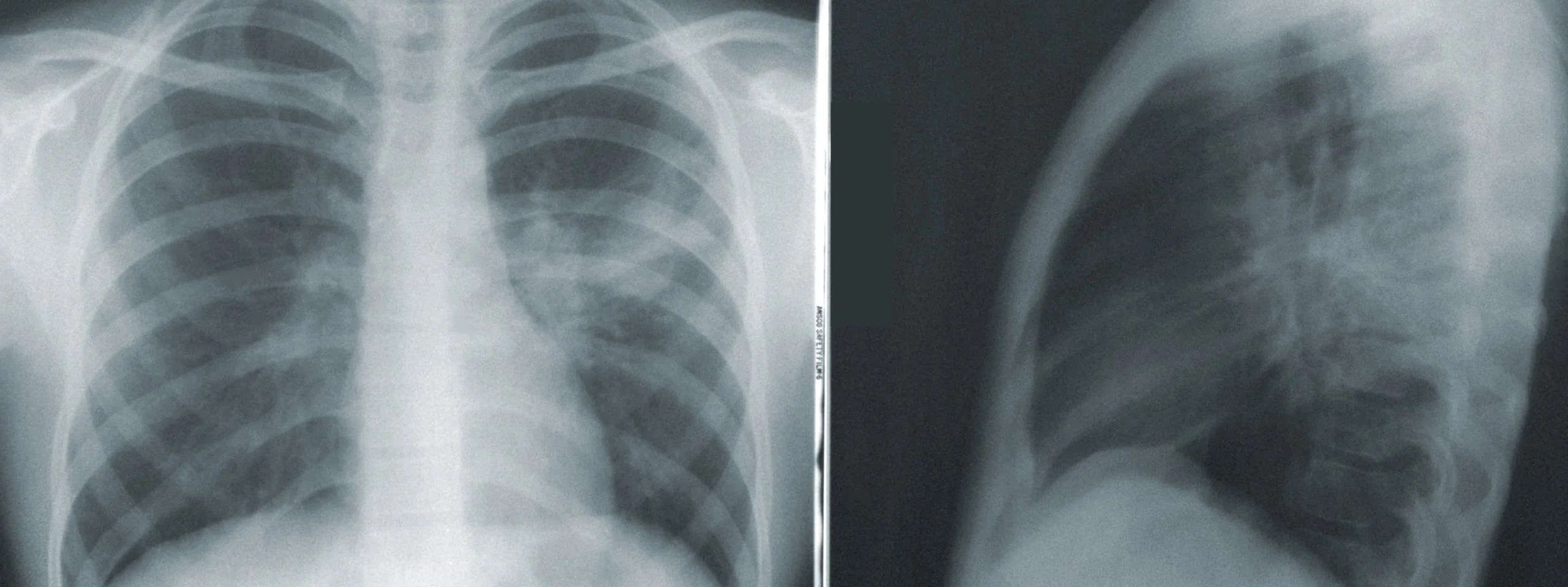 Medical Physics Vs Health Physics Careers: Which Path Is Right For You? | Biomedical Graduate Education | Georgetown University