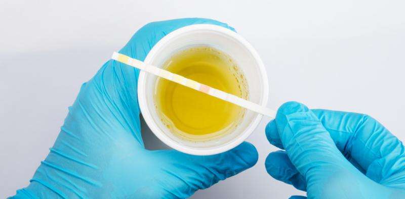 Urinalysis Bioscint
