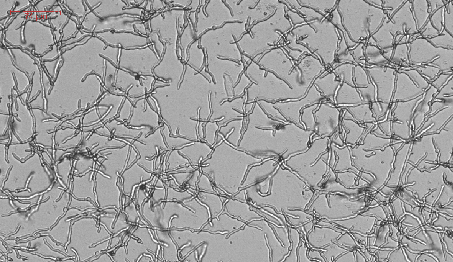 Fungal Spores Under Microscope