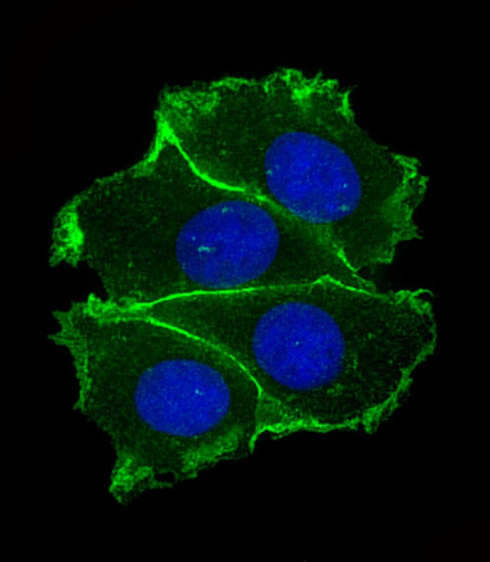 CDH1 (9C8) Monoclonal Antibody Bioss