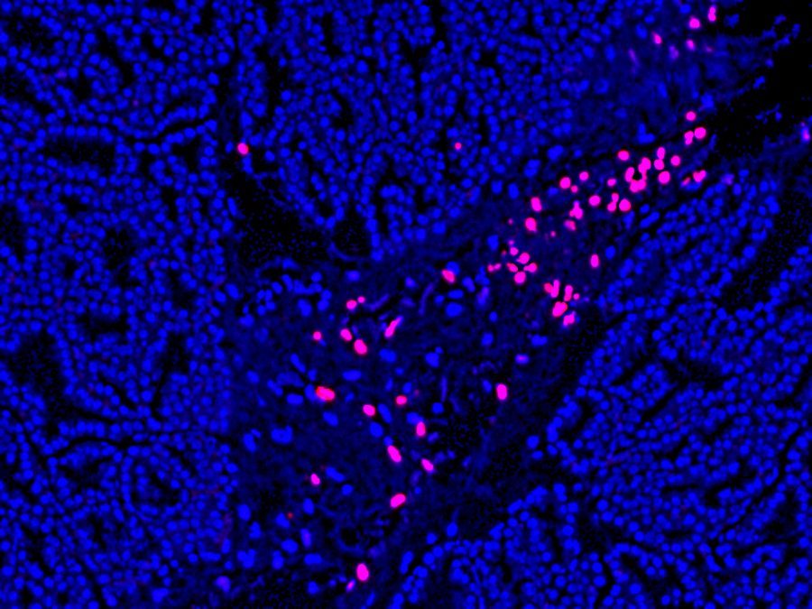 TUNEL Assay Apoptosis Detection Kit Biotium