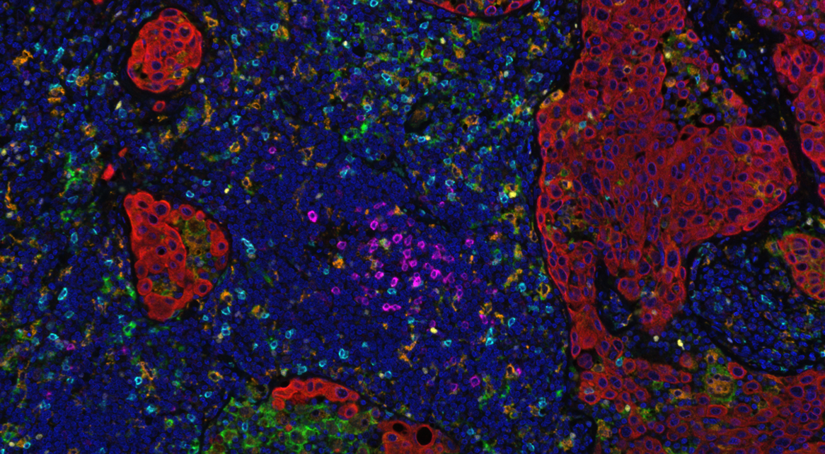 Multiplex Immunofluorescence in Immune Oncology