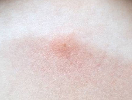 Do Boxelder Bugs Bite? {How Dangerous are they?} » Birds & Wild