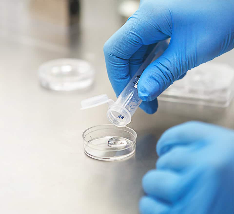 Testicular Biopsy Test for Male Birla Fertility & IVF